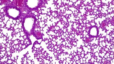 Pulmones de ratón con píldora viva activa combatiendo presudomonas aerugionosa.
