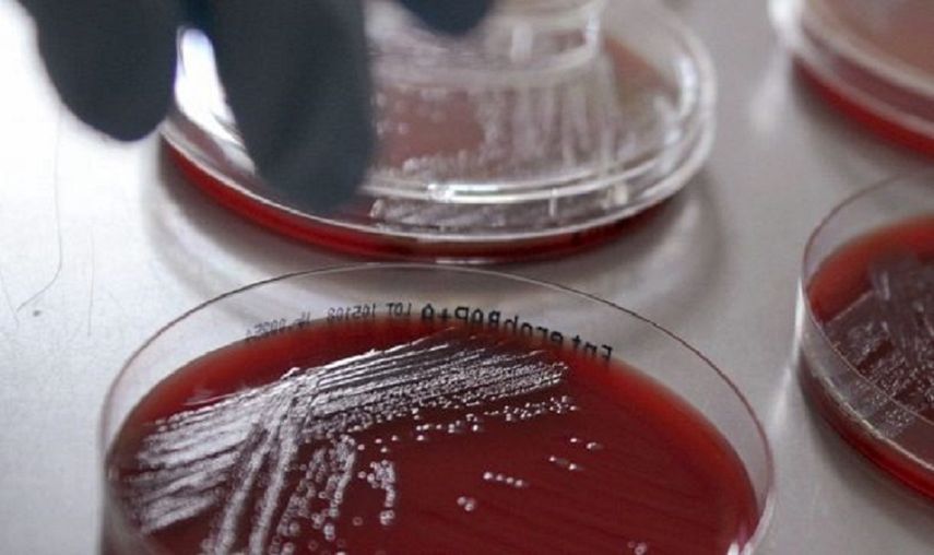 La infección también puede ocasionar úlceras en la piel de las personas afectadas.