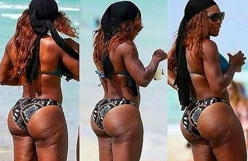 Serena Williams, una de las atletas más famosas del mundo, luce sus piernas con celulitis.&nbsp;