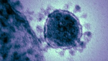 La rueda de prensa de la OMS dio a conocer los últimos resultados del más reciente brote de MERS. (Archivo)