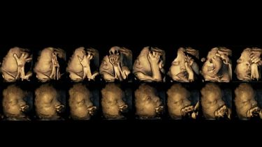 La secuencia de imágenes muestran la primera fila de un bebé de una madre fumadora, mientras que la segunda refleja el bebé de una madre no fumadora. (Imagen de la Universidad de Durham) 