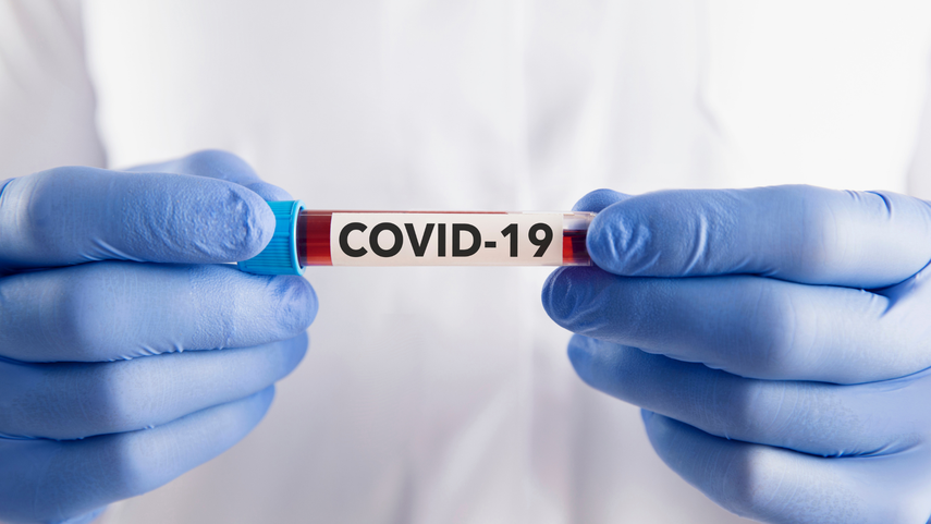 Aún se desconoce el origen verdadero del COVID-19