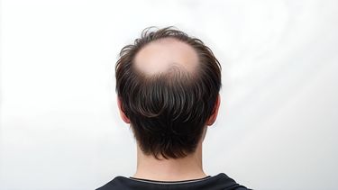 Imagen referencial.&nbsp;