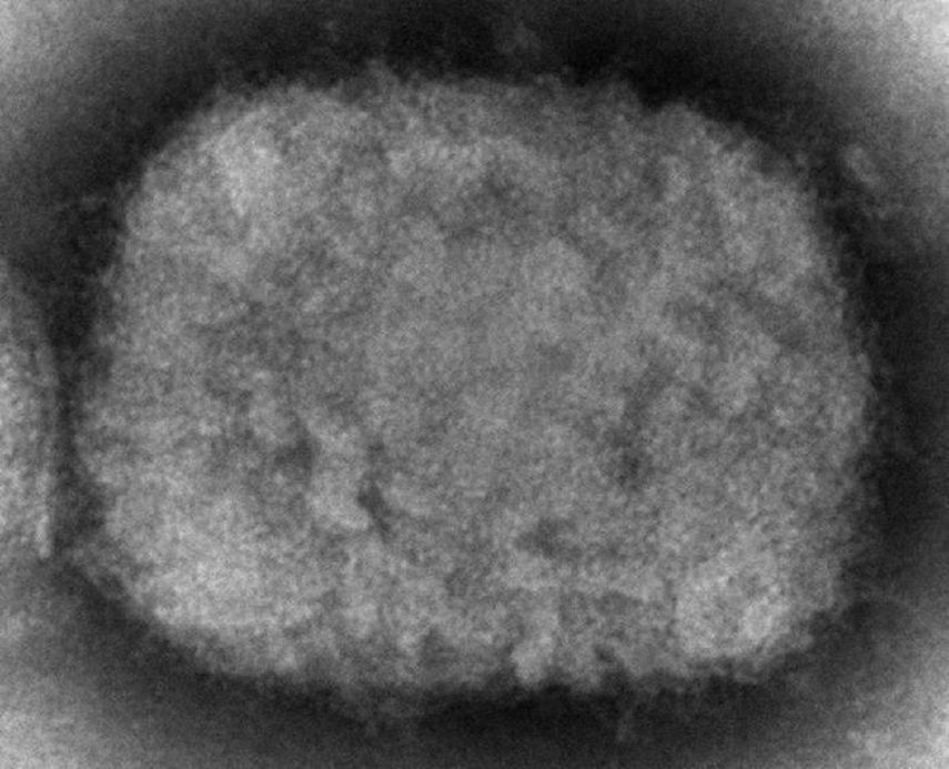 Esta imagen de microscopio de 2003 proporcionada por los Centros para el Control y la Prevención de Enfermedades muestra un virus de la viruela símica, obtenido de una muestra relacionada con un brote en perros.