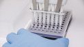 Una técnico de laboratorio prepara una PCR para el análisis de la viruela del mono, en el Hospital Ramón y Cajal, a 30 de mayo de 2022, en Madrid (España).      