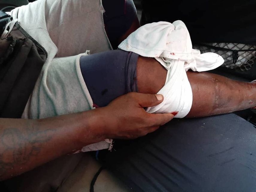 Un hombre herido tras las protestas en Cuba.&nbsp;