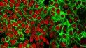 Esta imagen de microscopio difundida por el Centro Nacional de Investigación del Cáncer de Estados Unidos en 2015 muestra células cancerosas de colon teñidas de rojo. Un panel de expertos recomienda iniciar los tests de cáncer de colon a los 45 años en lugar de 50. Esta imagen de microscopio difundida por el Centro Nacional de Investigación del Cáncer de Estados Unidos en 2015 muestra células cancerosas de colon teñidas de rojo. Un panel de expertos recomienda iniciar los tests de cáncer de colon a los 45 años en lugar de 50.