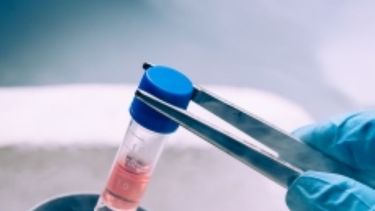 Las células madres de donantes de familiares son bien toleradas por los pacientes pediátricos (Tomado de Internet)