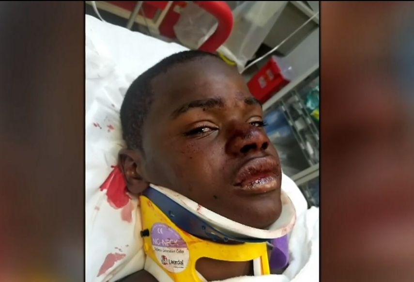 Familiares de Cameron Mills, quien está hospitalizado en el Jackson Memorial, consideran un milagro que haya sobrevivido al impacto.