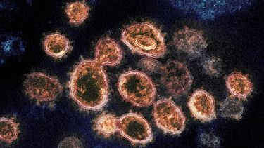 Esta imagen de microscopio eletrónico provista por el Instituto Nacional de Alergia y enfermedades infecciosas muestra partículas del virus SARS-CoV-2 que causan COVID-19 aisladas de un enfermo en EEUU.&nbsp;