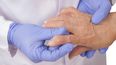 La artritis es incurable, salvo en aquellos casos en los que la enfermedad es causada por una infección (Cortesía)