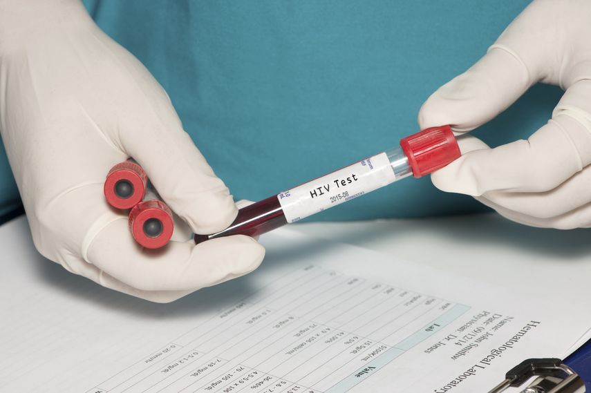 Según los datos de 2016, 47 personas de cada 100.000 habitantes del área metropolitana de Miami-Dade son portadores del virus&nbsp;VIH.