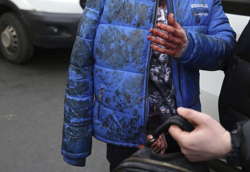 Un herido es fotografiado a las afuera de la estación del metro de San Petersburgo &nbsp;donde este lunes una bomba estalló dejando al menos 10 muertos.&nbsp;&nbsp;