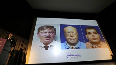 Hardison sufrió quemaduras de tercer grado hace catorce años cuando trabajaba como bombero voluntario y al entrar en una casa en llamas en busca de una mujer, el techo se derrumbó sobre él. (EFE)