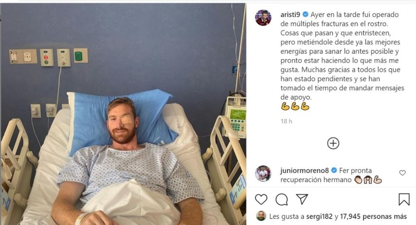 El delantero del Puebla sufrió las fracturas el pasado viernes en el compromiso contra el Queretaro por la séptima fecha de la Liga Mx y este domingo fue operado