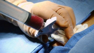 reparar la medula espinal con estructuras impresas en 3d