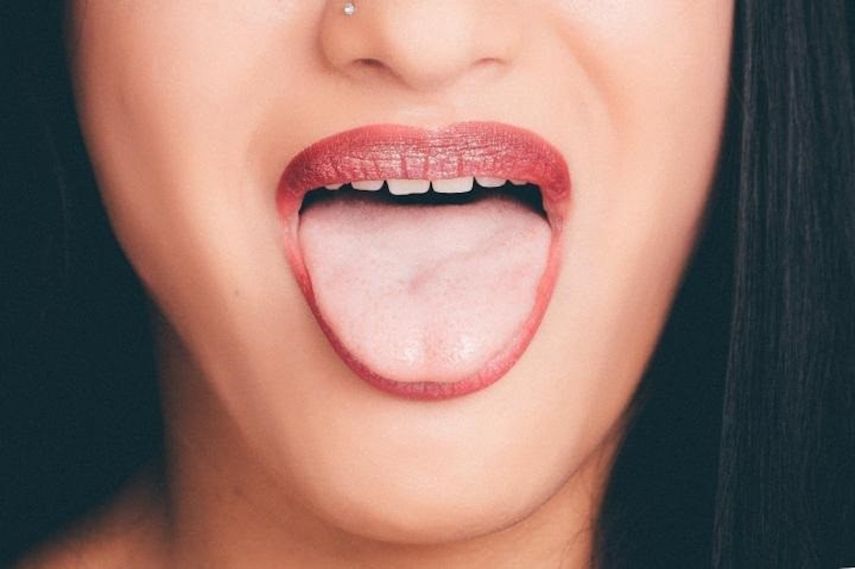 Las diferencias en la abundancia de ciertas bacterias que viven en la lengua pueden distinguir a los pacientes con cánceres pancreáticos tempranos de individuos sanos.