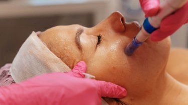 El tratamiento en el rostro con plasma rico en plaquetas es conocido como el facial Hollywood. 