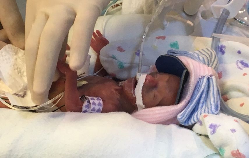 &nbsp;Lailie Victoria, una bebé de casi cuatro meses y medio que pesó al nacer solo 13 onzas (poco más de 368 gramos), recibió hoy el alta en un hospital pediátrico de Miami con un peso de 5,1 libras (2,3 kilos).