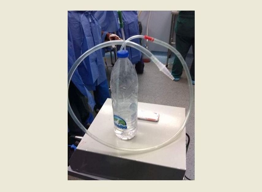 Una botella de agua la usan como drenaje para tubo del tórax, en el Hospital Universitario de Caracas. (TWITTER)