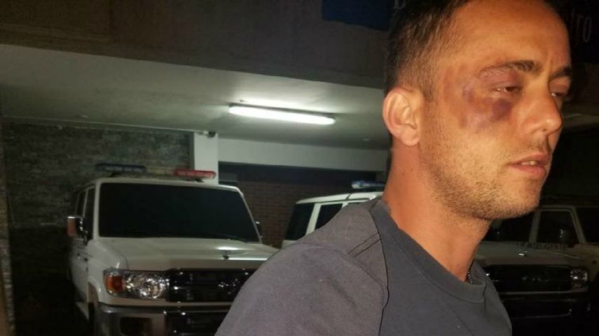 Me torturaron y amenazaron con matarme. Volví a nacer para seguir informando la verdad y luchar más por mi país Venezuela, precisó Medina a través de su cuenta en Twitter.