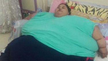 mujer egipcia pierde 100 kilos en cuatro semanas