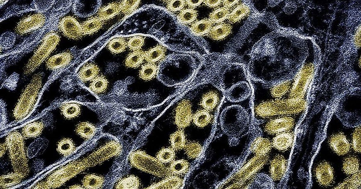 Reportan la segunda muerte del año vinculada a gripe aviar en Estados Unidos