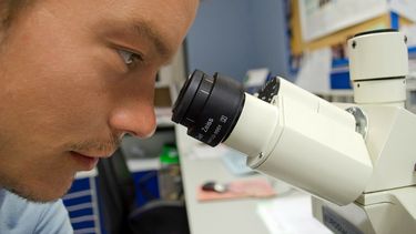 Un cient&iacute;fico investiga c&eacute;lulas cancer&iacute;genas.