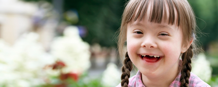 Niña con síndrome de Down.&nbsp;