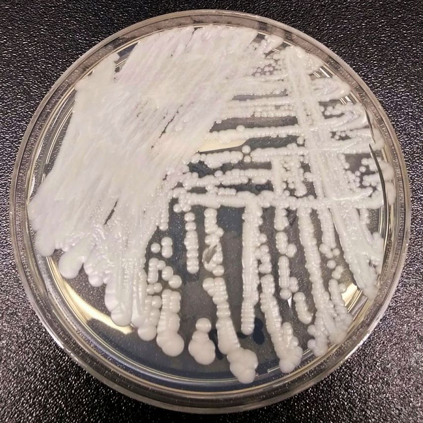 En esta fotografía de 2016 proporcionada por los Centros para el Control y la Prevención de Enfermedades de EEUU se muestra una cepa de la especie de hongo candida auris cultivada en una caja de petri en un laboratorio de la agencia.