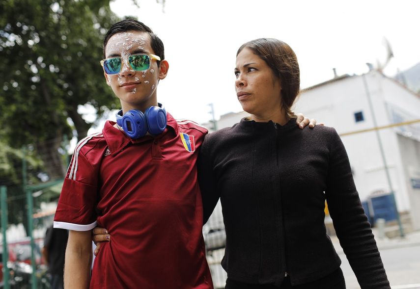 Rufo Chacón, de 16 años, utiliza gafas reflectantes tras perder la vista debido a perdigones disparados por la policía durante una protesta, y su madre, Adriana Parada, en Caracas, el viernes 19 de julio de 2019.