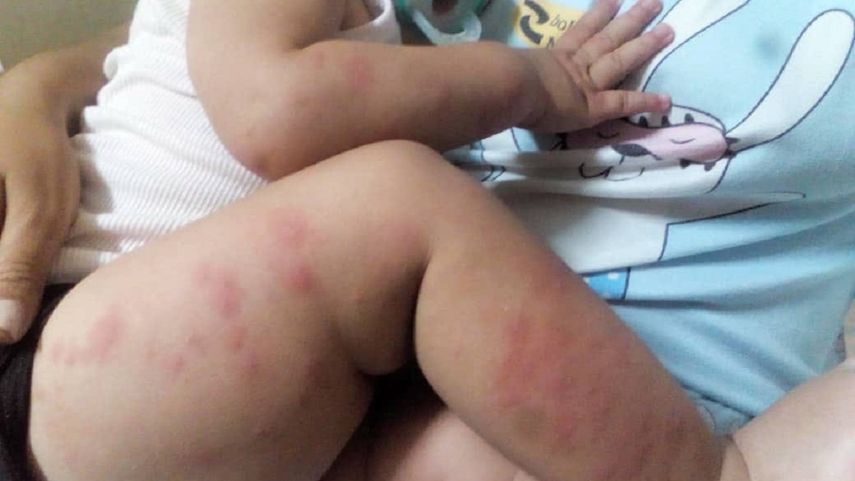 Niños en Cuba se llevan la peor parte de la crisis